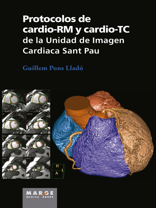 Title details for Protocolos de cardio-RM y cardio-TC de la Unidad de Imagen Cardiaca Sant Pau by Guillem Pons Lladó - Available